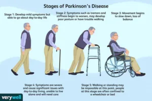 Parkinson's Stages